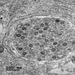 Un nouveau test sérologique fiable et peu couteux pour mieux suivre la progression de la pandémie de Covid-19