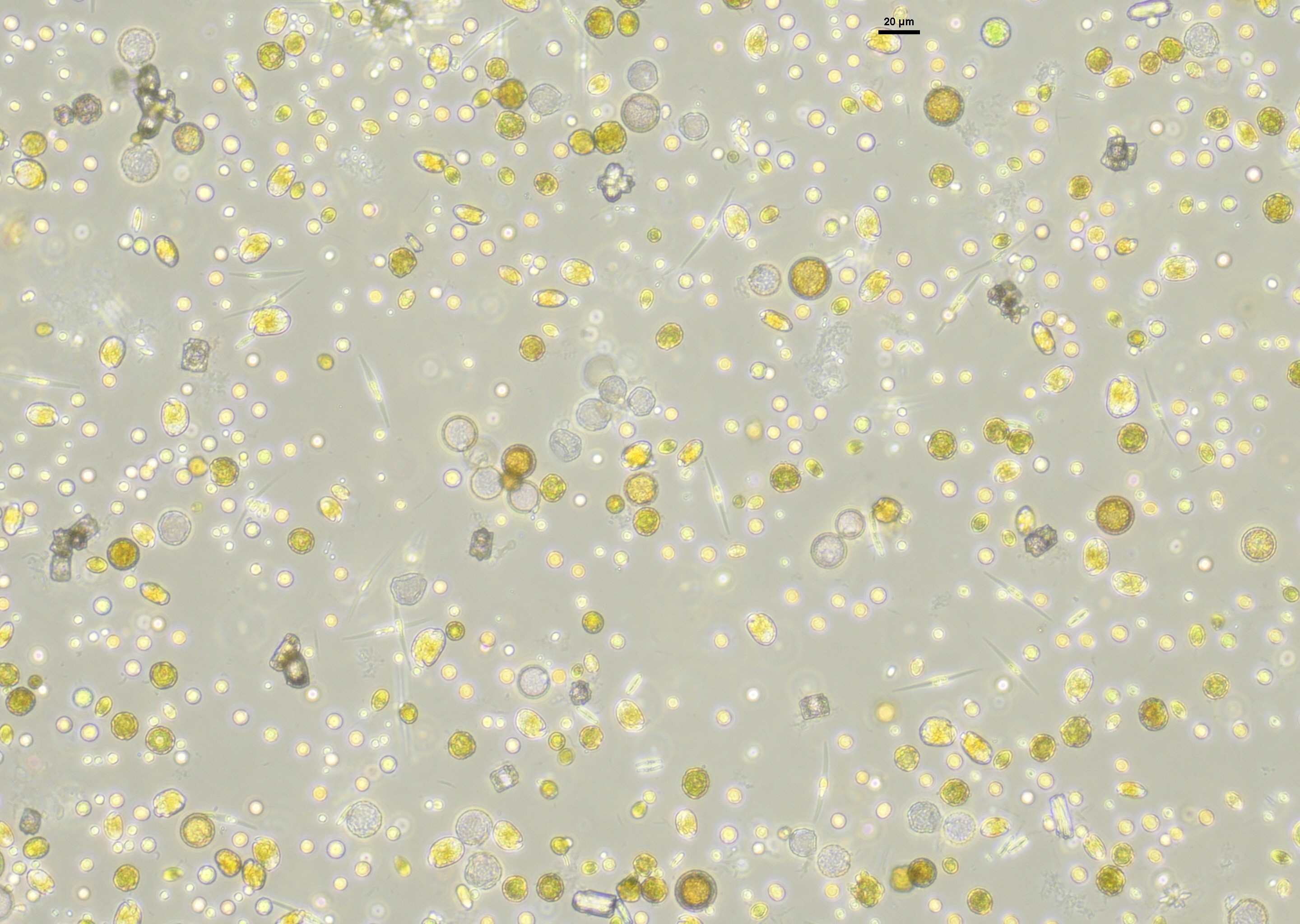 Vue microscopique d’une communauté de phytoplancton marin. © Elvire Bestion