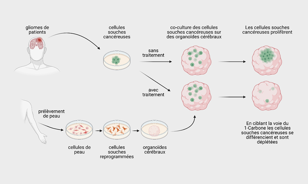 Des mini-cerveaux pour la recherche en cancérologie