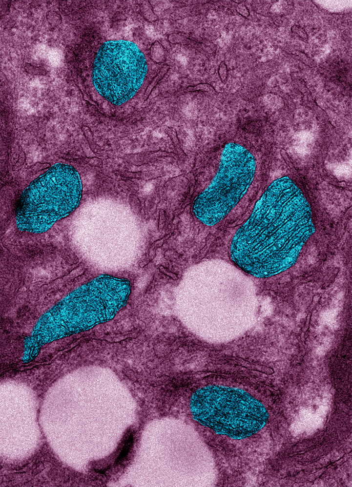 Comment le bacille de la tuberculose tire profit des lipides de son hôte